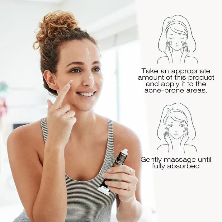 Sumifun – Bee Venom Anti-Acne Gel (Original)