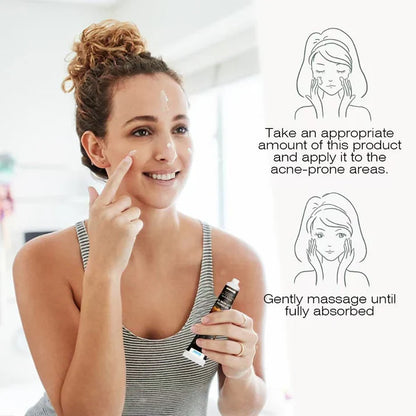 Sumifun – Bee Venom Anti-Acne Gel (Original)