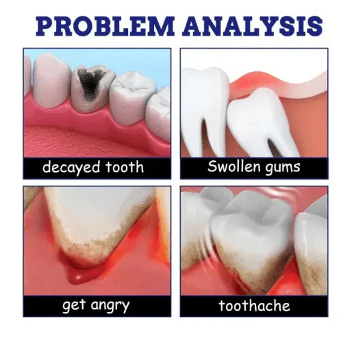 🔥South Moon Instant Toothache Relief Spray